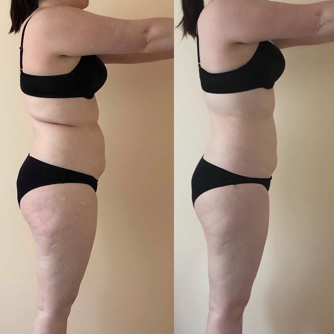 Venus Legacy después