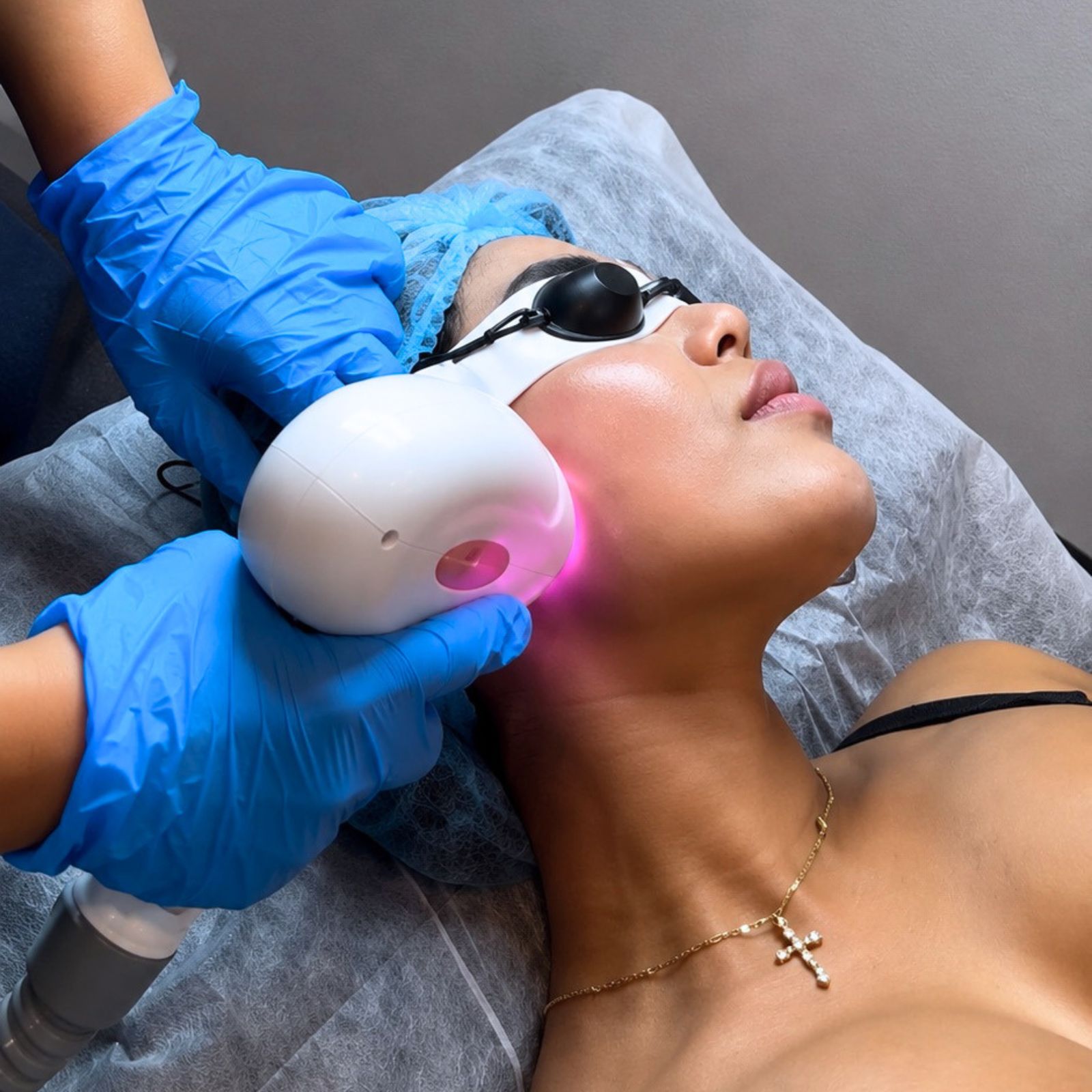Natural-looking lip filler result at NYC Skincare Studio