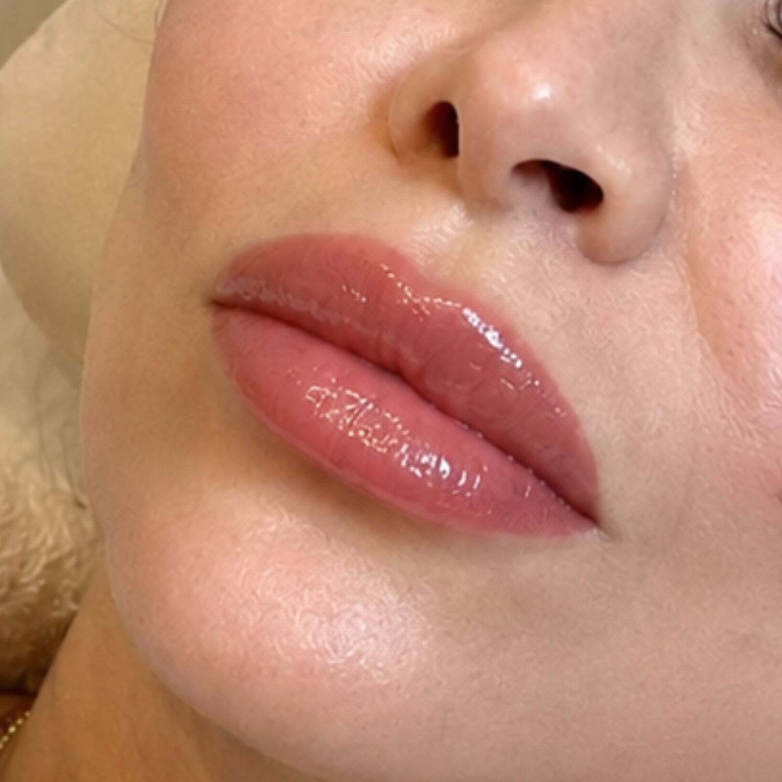 Assessment of the lip contour before the procedure