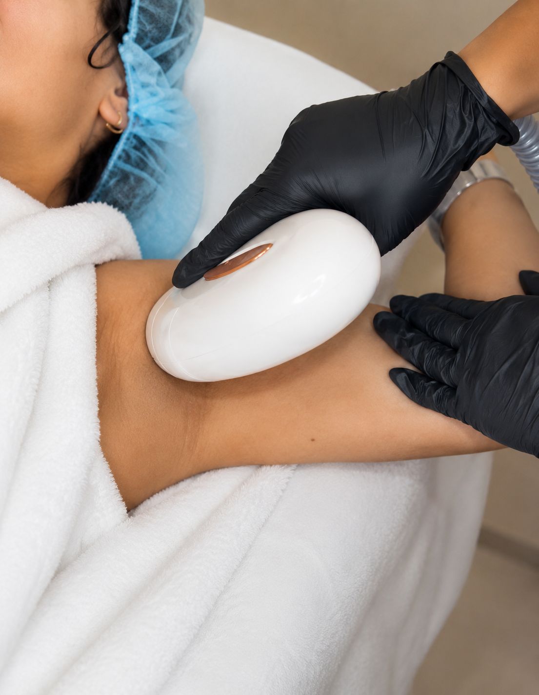 Diode laser hair removal session in New York