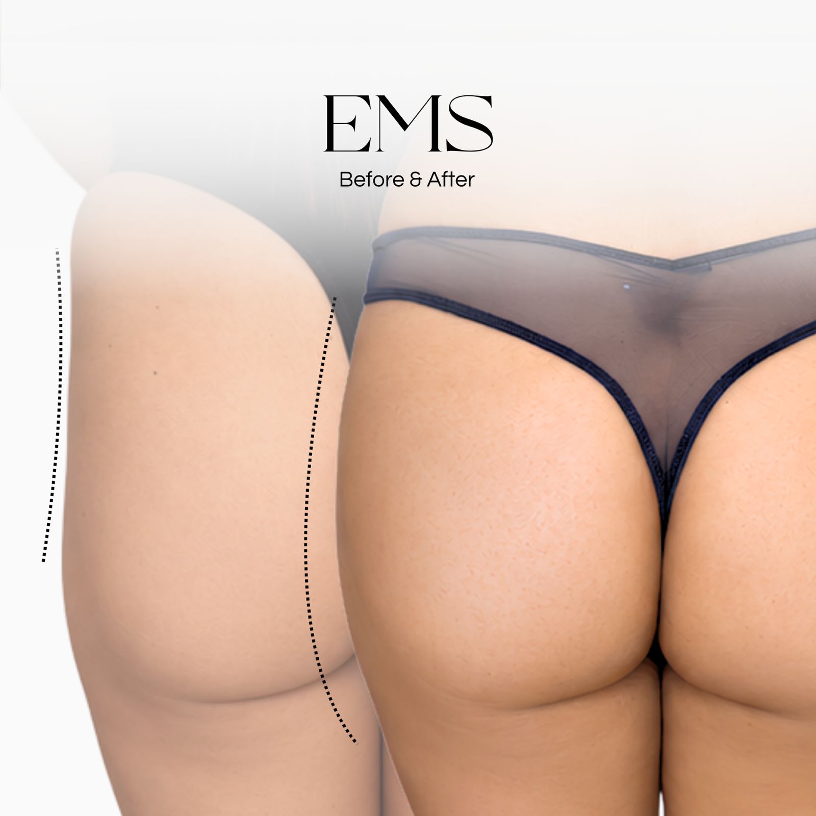 Firming Treatment at NYC Skin Care Studio